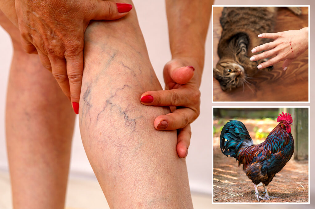 The forensic pathologist of "Doctor Death" reveals the worst ways to die: "Never trust a rooster"